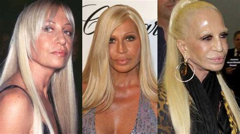 donatella versace foto bikini wikipedia|donatella versace before and after surgery.